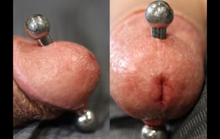 Photo of adult body piercing age 18+ only - Spider Bite Body Piercing Manchester NH